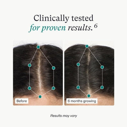 Nutrafol-hairline growth supplement